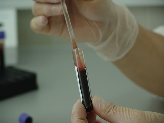 Blood test via https://pixabay.com/photos/blood-vial-analysis-laboratory-20745/